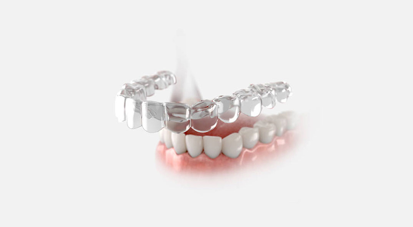 Invisalign Enamel Damage What Your Orthodontist Isnt Telling You - t7uoenb