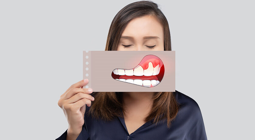 What Causes My Gums to Recede?