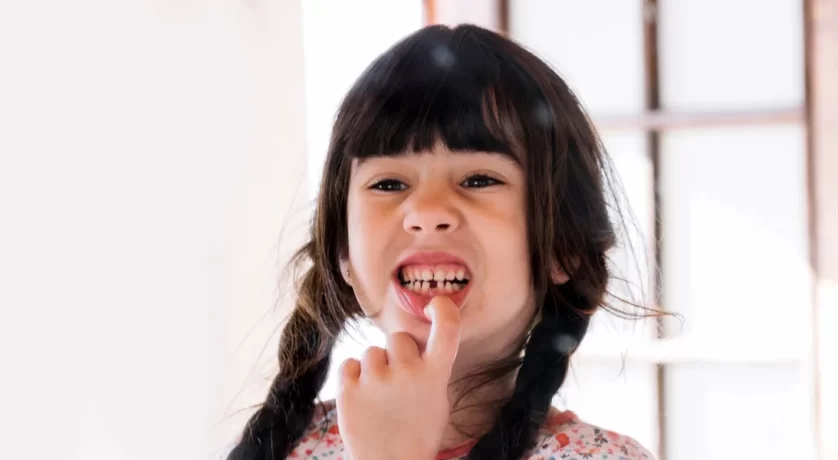 What Should You Do If You Break or Knock Out a Tooth?